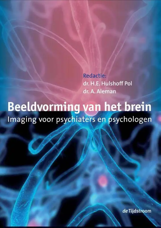 Beeldvorming van het brein / Druk 1 Favoriet