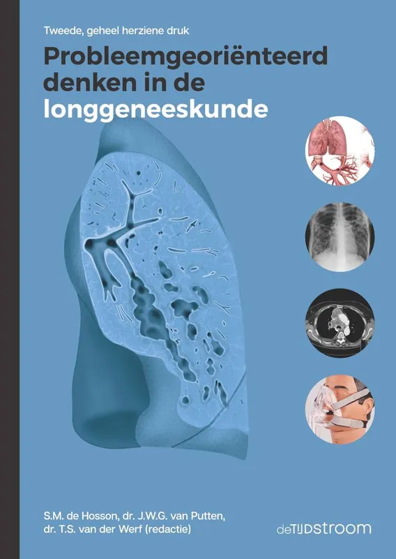 Probleemgeoriënteerd denken in de longgeneeskunde / Druk 2 Alleen Vandaag