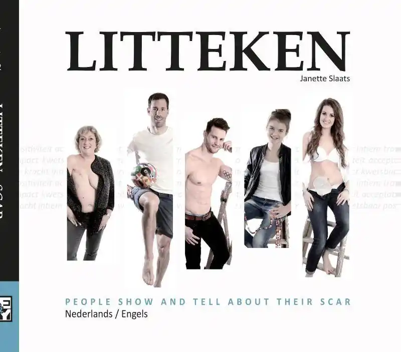 Litteken / 1st Edition Aanbieding