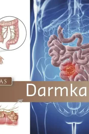 Zorgatlas Darmkanker / Druk 1 Koop Online