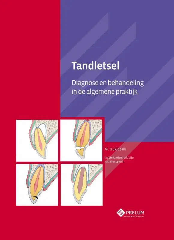 Goedkoop Tandletsel / Druk 1