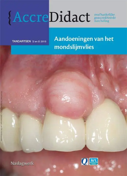 Hete Deal Aandoeningen van het mondslijmvlies / Druk 1