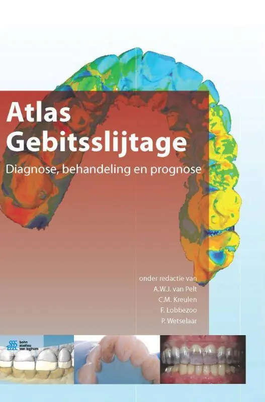Atlas gebitsslijtage / Druk 1 Meest Verkocht