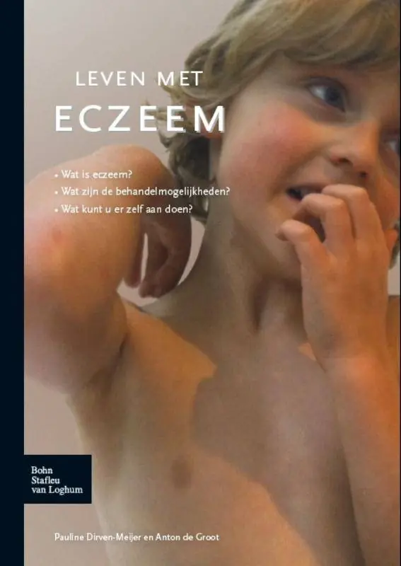 Leven met eczeem / Druk 1 Laatste Versie
