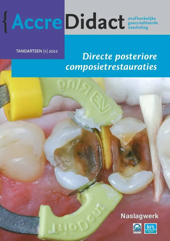 Directe posteriore composietrestauraties / Druk 1 Korting