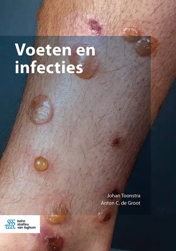 Voeten en infecties / Druk 1 Nieuw